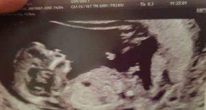 Mamma scorge un angelo nella prima ecografia