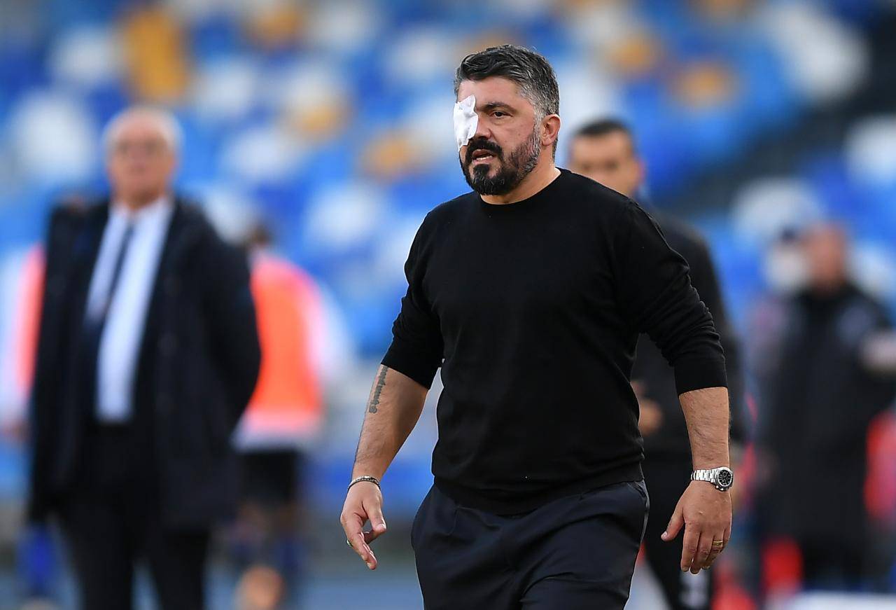 Gattuso occhi