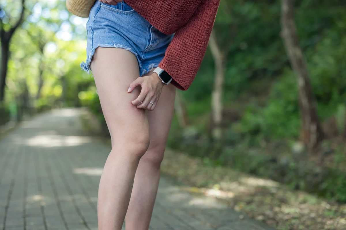 Donna che si gratta la gamba in un parco