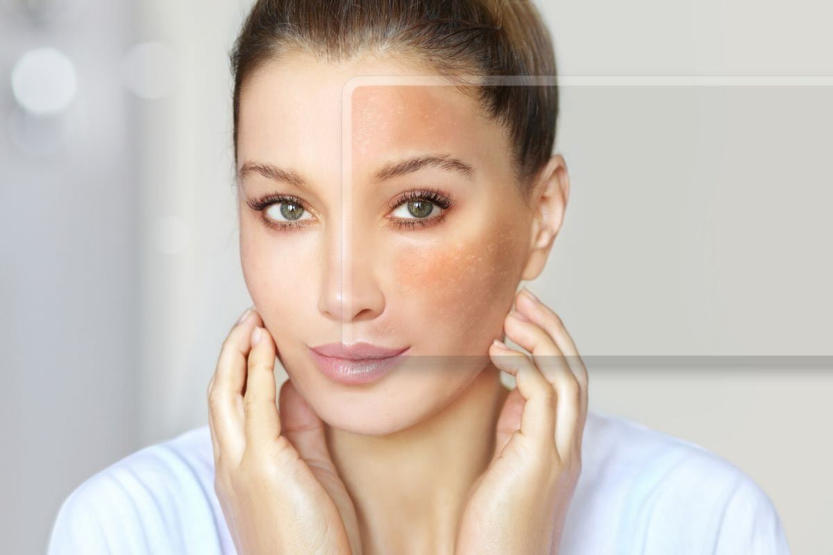lente che mostra i danni sulla pelle di una giovane donna