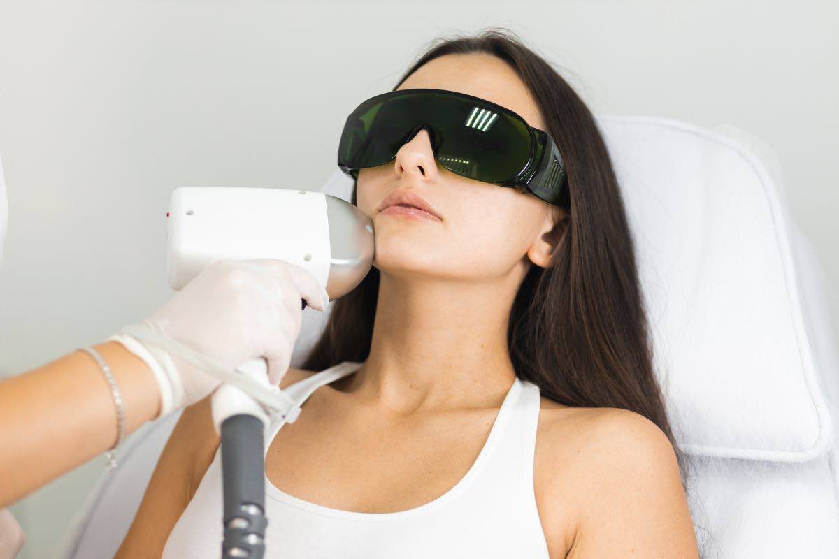 Donna che si sottopone a trattamento laser sul viso