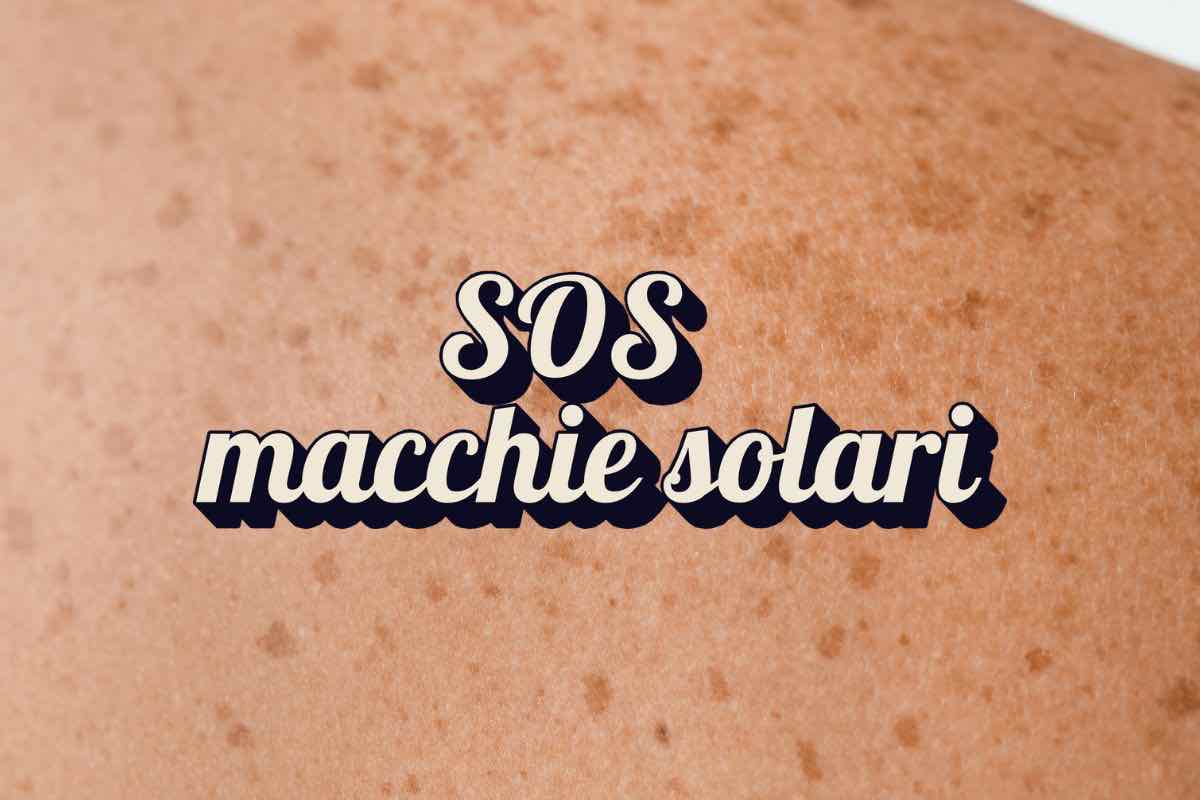 Macchie solari sulla pelle e scritta "SOS macchie solari" 